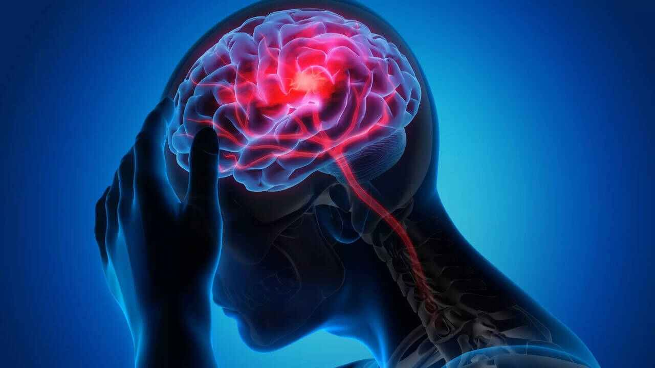 Brain Stroke: అలాంటి వారికే బ్రెయిన్ స్ట్రోక్.. వెంటనే ఈ అలవాట్లను మార్చుకోండి.. లేదంటే ప్రాణానికే ప్రమాదం..