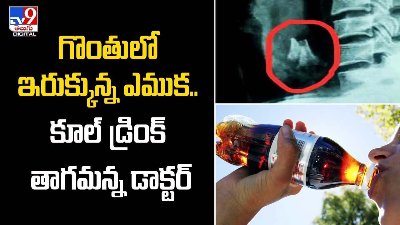 గొంతులో ఇరుక్కున్న ఎముక !! కూల్ డ్రింక్ తాగమన్న డాక్టర్ !!