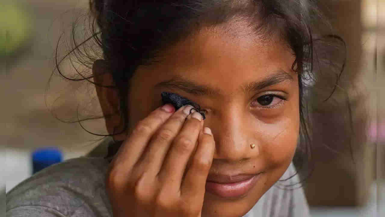 Conjunctivitis: తెలుగు రాష్ట్రాల్లో కలకలం రేపుతోన్న కండ్లకలక.. భారీగా పెరుగుతోన్న కేసులు