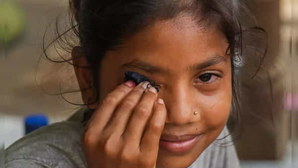 Conjunctivitis: తెలుగు రాష్ట్రాల్లో కలకలం రేపుతోన్న కండ్లకలక.. భారీగా పెరుగుతోన్న కేసులు