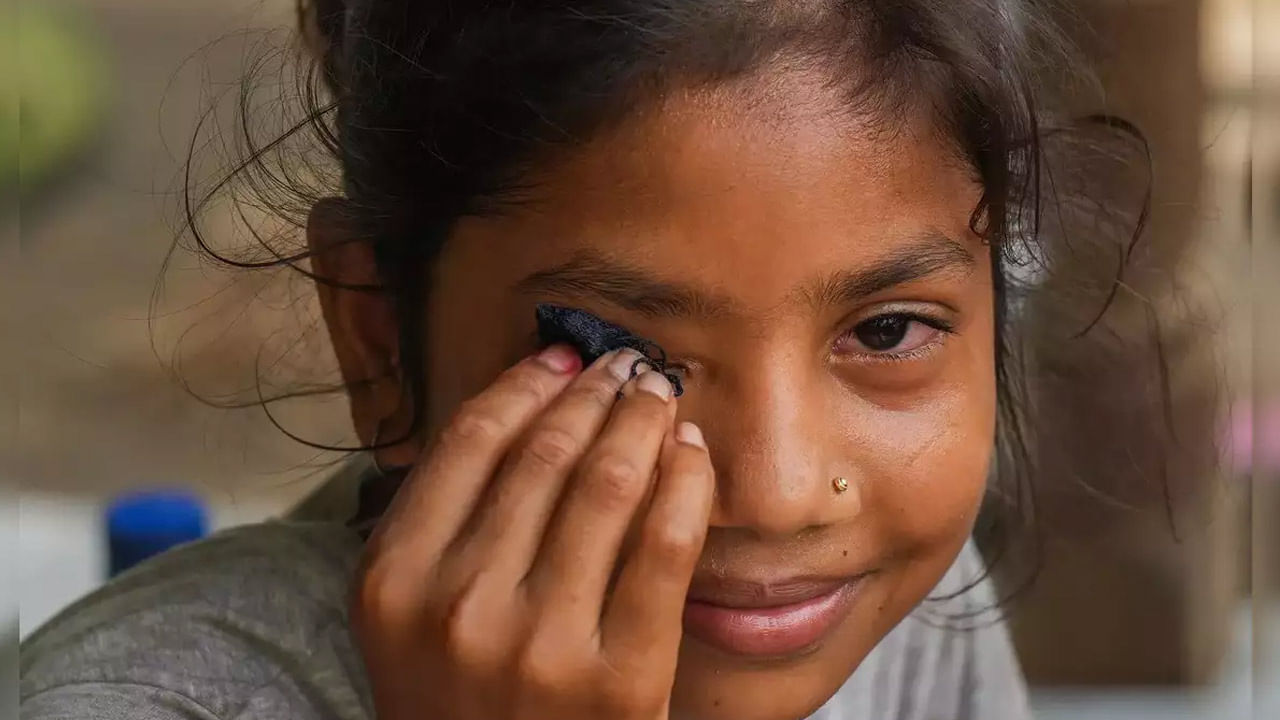 Conjunctivitis: తెలుగు రాష్ట్రాల్లో కలకలం రేపుతోన్న కండ్లకలక.. భారీగా పెరుగుతోన్న కేసులు