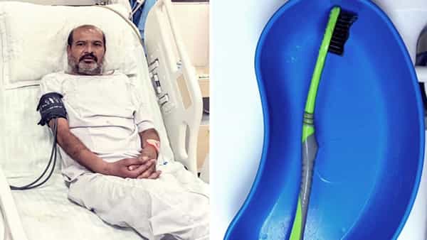 అతనికి 53 ఏళ్లు.. పళ్లు తోముకుంటూ టూత్బ్రష్ మింగేశాడు