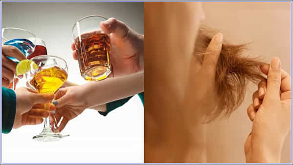 Hair Loss: మద్యపానం, ధూమపానం జుట్టు రాలడానికి కారణమవుతుందా? ఈ అలవాటు వల్ల బట్టతల వస్తుందా?