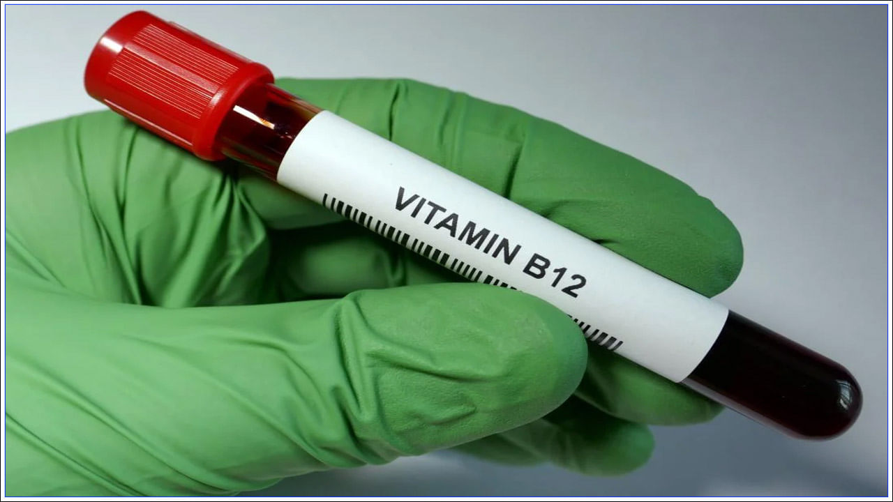 రోజుకు ఎంత విటమిన్ బి12 అవసరం: ఒక వయోజన వ్యక్తికి ప్రతిరోజూ 2.4 మైక్రోగ్రాముల విటమిన్ B12 అవసరం. ఇంత విటమిన్ లభించకపోతే శరీరంలో దాని లోపం మొదలవుతుంది. దీన్ని గుర్తించడానికి విటమిన్ B12 రెగ్యులర్ చెకప్ చేయండి. తగ్గిపోతే, ఆహారంపై శ్రద్ధ వహించండి. తర్వాత వైద్యున్ని సంప్రదించడం మంచిది. విటమిన్ B12 ఇంట్రామస్కులర్ ఇంజెక్షన్ తీసుకోవాలని వైద్యుడు సలహా ఇవ్వవచ్చు. 