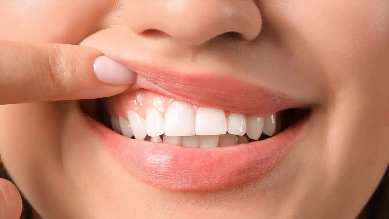 Dental Health: మీ చిగుళ్ల రంగు చూసి రోగమేంటో చెప్పేస్తారు తెలుసా? పూర్తి వివరాలు ఇవి..