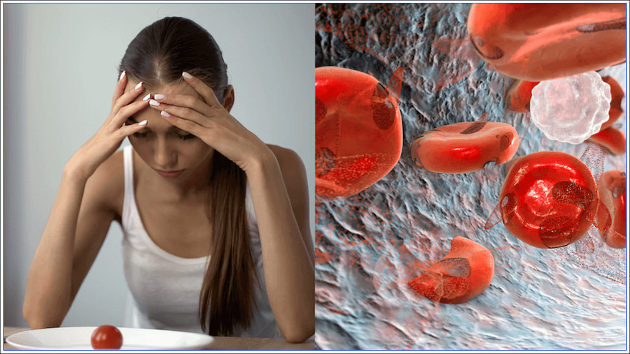 ఐరన్ లోపం వల్ల రక్తహీనత వస్తుంది. అయితే ఇందులో పెద్దగా భయపడాల్సిన పనిలేదు. మీరు సరైన ఆహారం తీసుకుంటే ఇనుము లోపాన్ని సులభంగా నివారించవచ్చు. ఐరన్ లోపాన్ని భర్తీ చేయడానికి మీరు ఆకు కూరలు, చేపలు, మాంసం, మాంసం కాలేయం, వివిధ రకాల పప్పులు, తాజా పండ్లు, బాదం, ఎండుద్రాక్ష, ఓట్స్ మొదలైన వాటిని తినవచ్చు. అలాగే, టీ, కాఫీ, పాలు, పాల ఉత్పత్తుల వినియోగాన్ని తగ్గించండి.