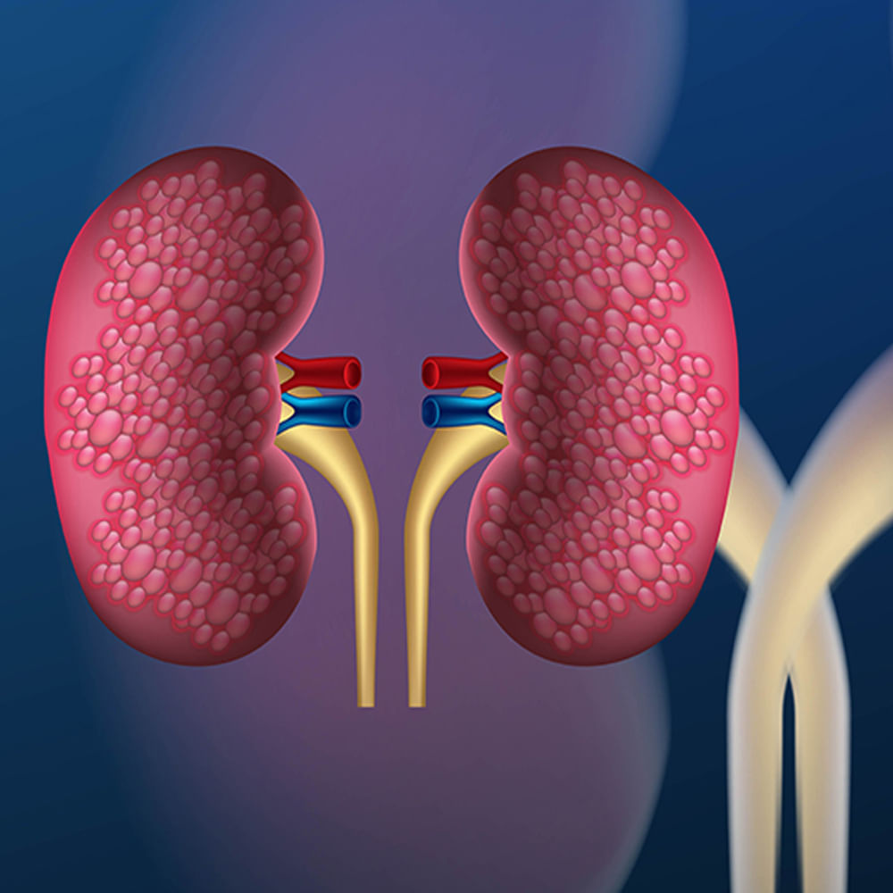 తొలినాళ్లలోనే జాగ్రత్త వహిస్తే సమస్య నుంచి బయటపడే అవకాశం ఉంది. మూత్రపిండ వ్యాధుల లక్షణాలు ఏంటో ఇప్పుడు తెలుసికుందాం.