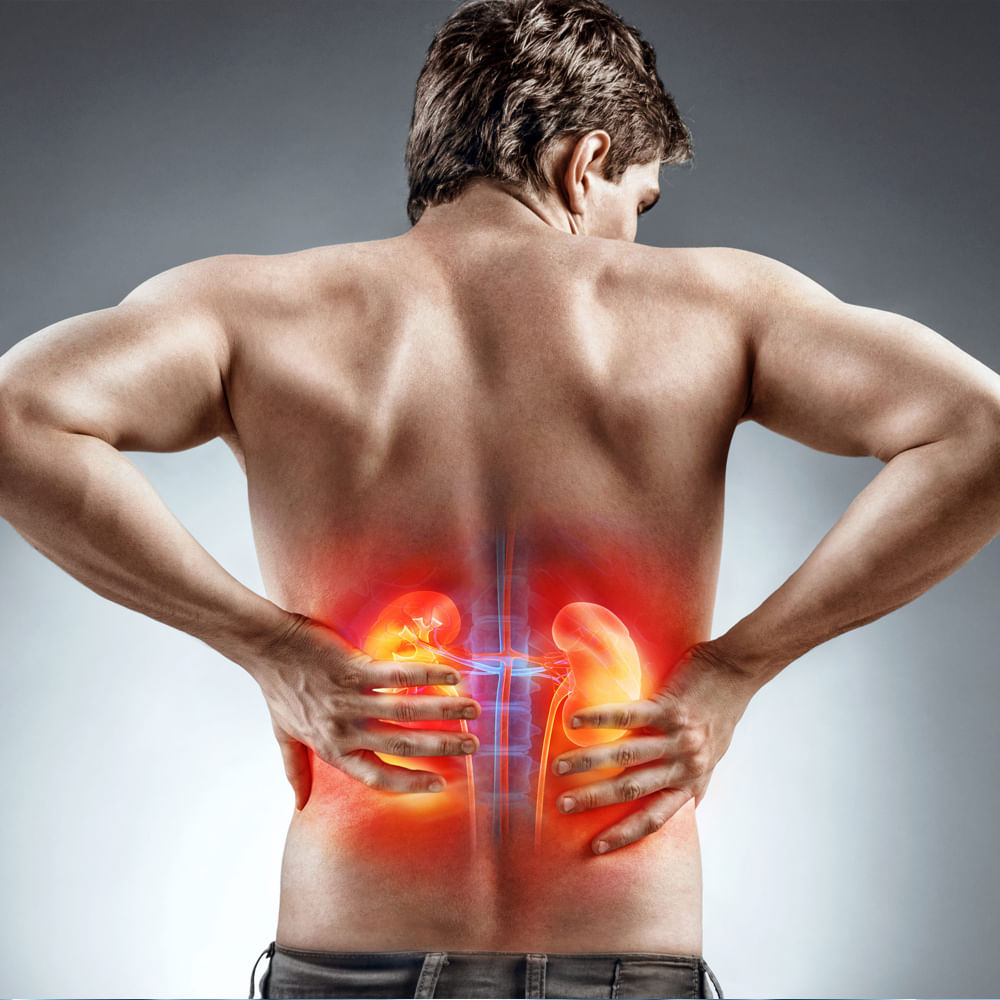 కిడ్నీ ఇన్ఫెక్షన్ తీవ్రతరమైన సందర్భాల్లో కిడ్నీ మార్పిడి చేయవలసి వస్తుంది. చాలామందికి కిడ్నీల్లో రాళ్లు కారణంగా చాలా నష్టం జరుగుతుంది. కాబట్టి మూత్రానికి సంబంధించిన ఎలాంటి లక్షణం కనిపించిన వెంటనే వైదున్ని సంప్రదించాలి. మూత్రంలో ఉండే ప్రమాదకరమైన బ్యాక్టీరియా మూత్ర నాళం ద్వారా కిడ్నీకి చేరి, కిడ్నీ ఇన్‌ఫెక్షన్‌కు కారణమవుతుంది.