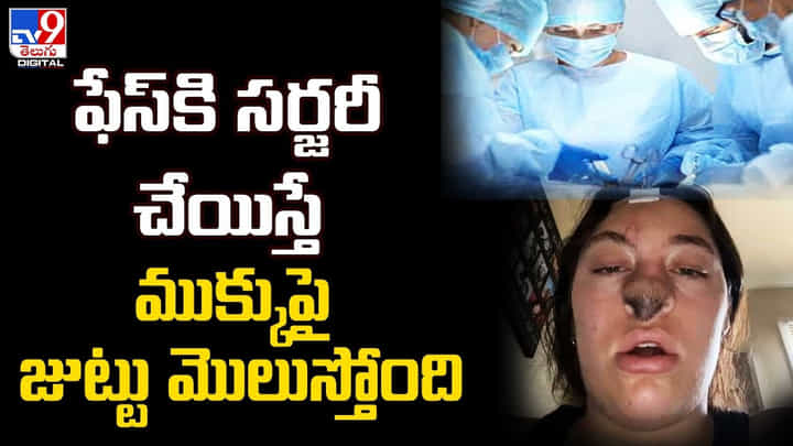 ఫేస్కి సర్జరీ చేయిస్తే ముక్కుపై జుట్టు మొలుస్తోంది ఫేస్కి సర్జరీ చేయిస్తే ముక్కుపై జుట్టు మొలుస్తోంది