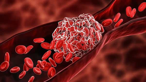 Blood Clots: రక్తం గడ్డలు కడుతుందా.. రోజూ వీటిని తింటే ఈజీగా కరిగిపోతాయ్!!