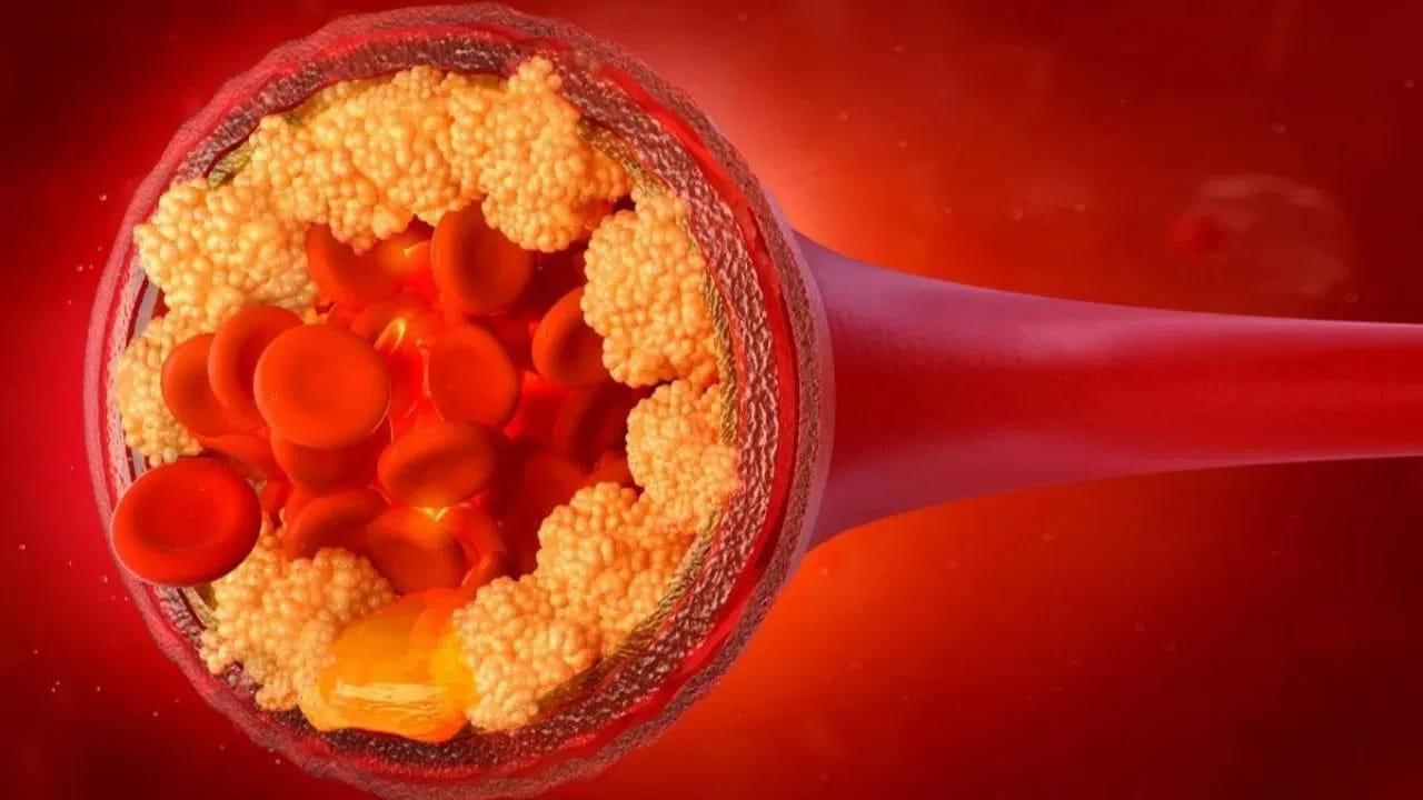 సమయం గడిచేకొద్దీ అధిక కొలెస్ట్రాల్ స్థాయిలు పెరుగుతాయి. ఇది శరీరంపై ప్రత్యక్ష ప్రభావాన్ని చూపుతుంది.