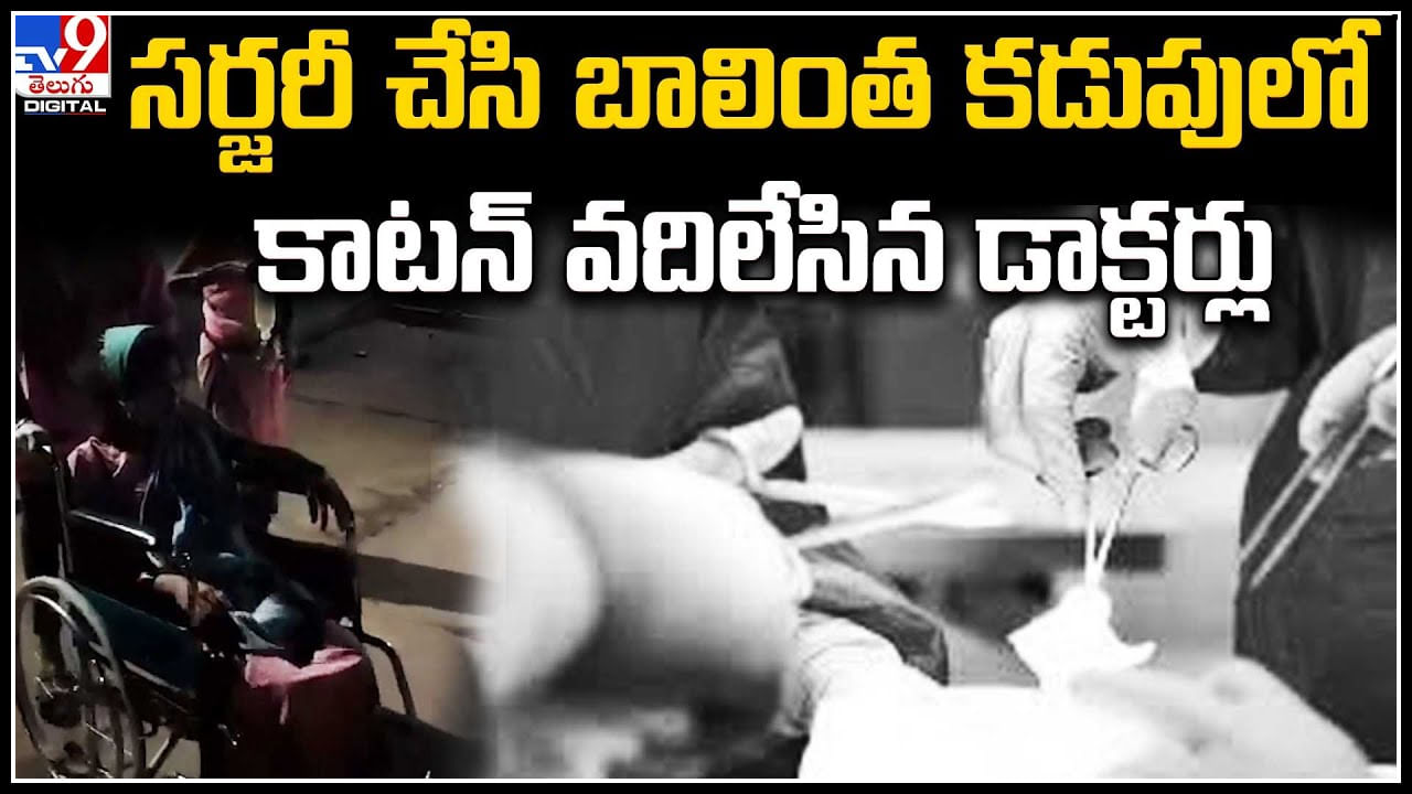 Viral: సర్జరీ చేసి బాలింత కడుపులో కాటన్ వదిలేసిన డాక్టర్లు.. మూత్రం ఆగిపోవడంతో అనుమానం. Viral: సర్జరీ చేసి బాలింత కడుపులో కాటన్ వదిలేసిన డాక్టర్లు.. మూత్రం ఆగిపోవడంతో అనుమానం.