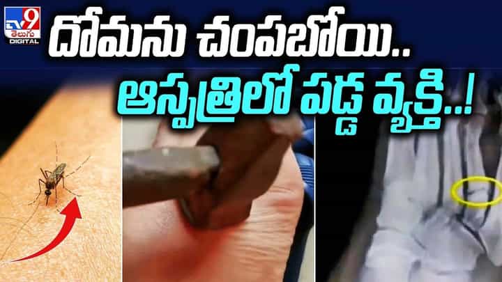 దోమను చంపబోయి ఆస్పత్రిలో పడ్డ వ్యక్తి !! దోమను చంపబోయి ఆస్పత్రిలో పడ్డ వ్యక్తి !!