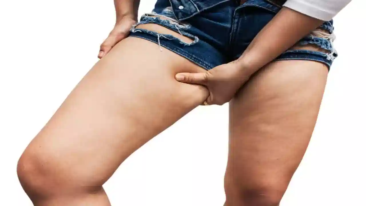 Home Tips for Thighs Burning: తొడలు రాసుకుపోయి ఎర్రగా, నల్లగా అవుతున్నాయా ? ఈ ఇంటి చిట్కాలు పాటిస్తే సరి!!