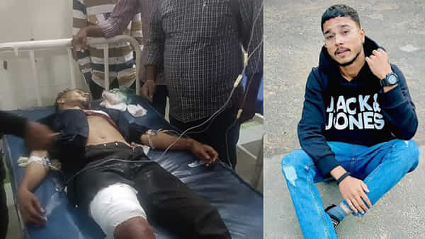 Kadapa: స్నేహం కోసం ప్రాణం ఇస్తానంటూ యువకుడు మృతి.. మద్యం మత్తులో తొడపై కోసుకొని..