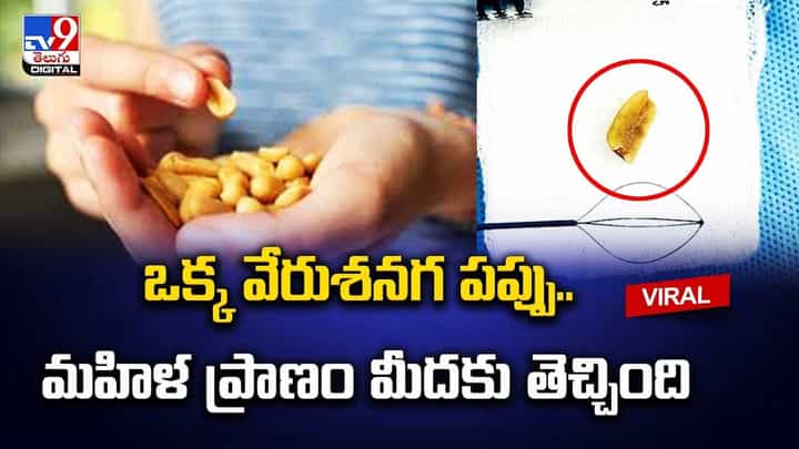 Peanut: ఒక్క వేరుశనగ పప్పు.. మహిళ ప్రాణం మీదకు తెచ్చింది.. Peanut: ఒక్క వేరుశనగ పప్పు.. మహిళ ప్రాణం మీదకు తెచ్చింది..