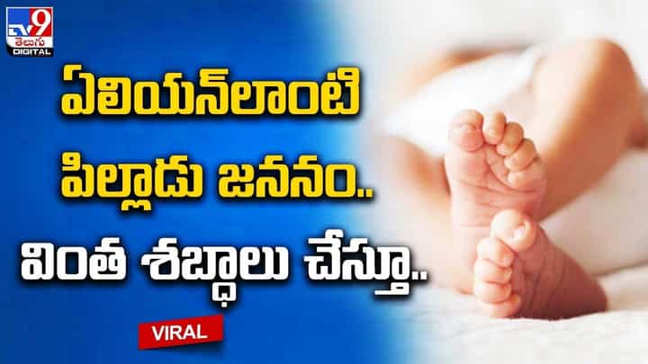 ఏలియన్లాంటి పిల్లాడు జననం.. వింత శబ్ధాలు చేస్తూ.. ఏలియన్లాంటి పిల్లాడు జననం.. వింత శబ్ధాలు చేస్తూ..