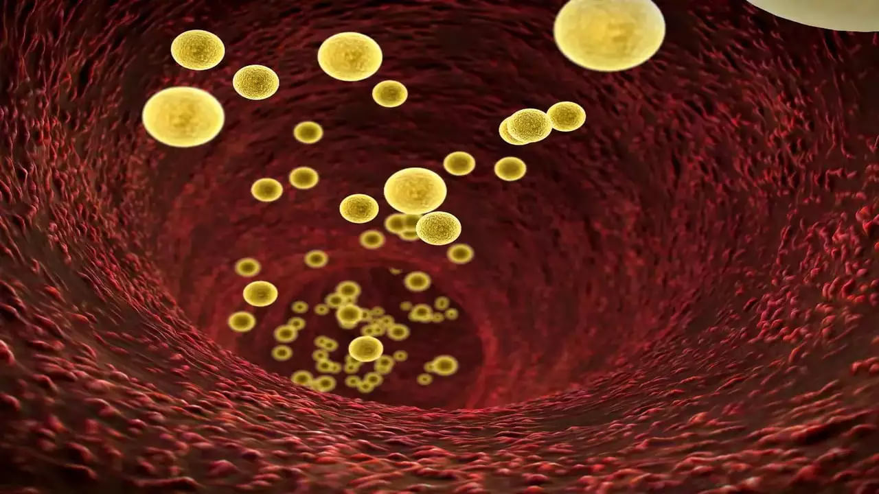 చెడు కొలెస్ట్రాల్: ఫైబర్ లేకపోవడం వల్ల శరీరానికి ఎదురయ్యే మరో సమస్య కొలెస్ట్రాల్. ఫైబర్ లోపం కారణంగా శరీరంలో చెడు కొలెస్ట్రాల్ లెవెల్స్ పెరిగిపోయి రక్తనాళాలను అడ్డంకిగా మారతాయి. ఫలితంగా బీపీ, గుండెపోటు సమస్యలు పెరుగుతాయి. అంటే ఫైబర్ లోపం ఏర్పడితే గుండె ప్రమాదంలో పడినట్లే. 