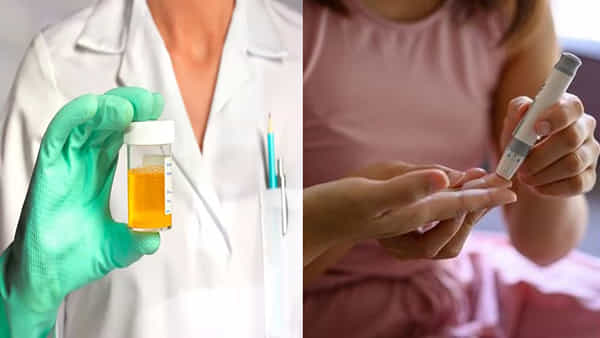 Diabetes: మూత్రంలో ఈ నాలుగు లక్షణాలు కనిపిస్తున్నాయా.. షుగర్ వ్యాధి ఉందో లేదో పరీక్ష తప్పనిసరి..