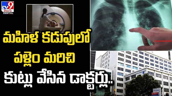 ప్రసవం కోసం వచ్చిన మహిళ.. కడుపులో ప్లేట్ పెట్టి కుట్టేసిన డాక్టర్లు !! ప్రసవం కోసం వచ్చిన మహిళ.. కడుపులో ప్లేట్ పెట్టి కుట్టేసిన డాక్టర్లు !!