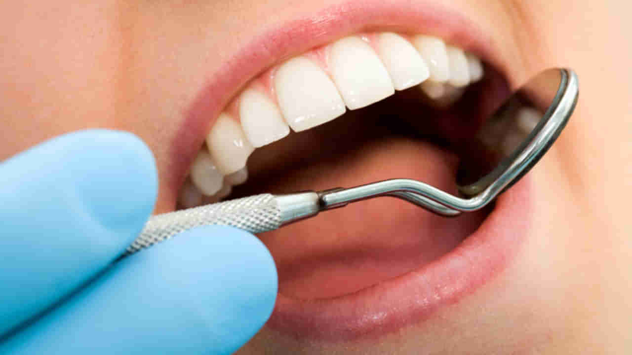 Teeth Cavity: పిప్పి పన్ను సమస్యతో నరకం చూస్తున్నారా.. అయితే ఈ సింపుల్ చిట్కా పాటించండి!!