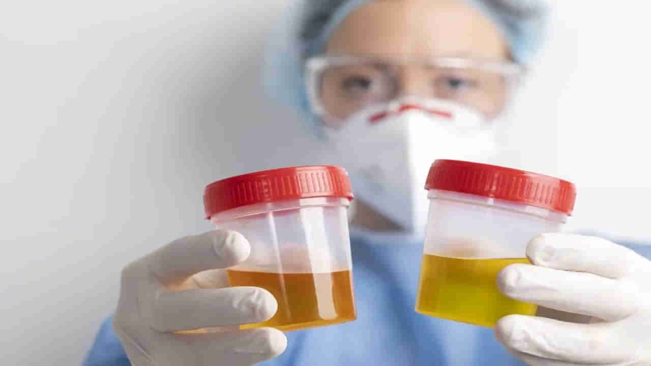 Urine Color: మూత్రం రంగు మీ ఆరోగ్య సమస్యను చెప్పేస్తుంది తెలుసా.. ఎలా తెలుసుకోవాలంటే..