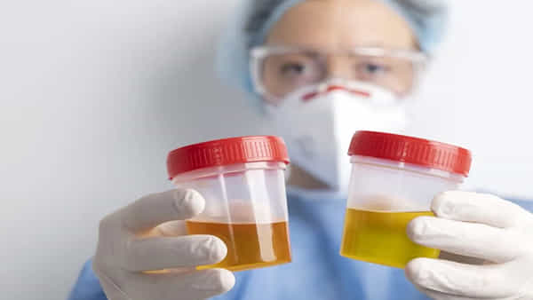 Urine Color: మూత్రం రంగు మీ ఆరోగ్య సమస్యను చెప్పేస్తుంది తెలుసా.. ఎలా తెలుసుకోవాలంటే..