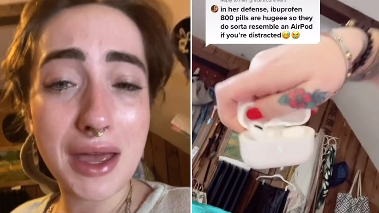 Viral News: విటమిన్ ట్యాబ్లెట్స్ అనుకుని ఎయిర్పాడ్లను మింగేసిన మహిళ.. నెక్ట్స్ ఏం జరిగిందంటే..