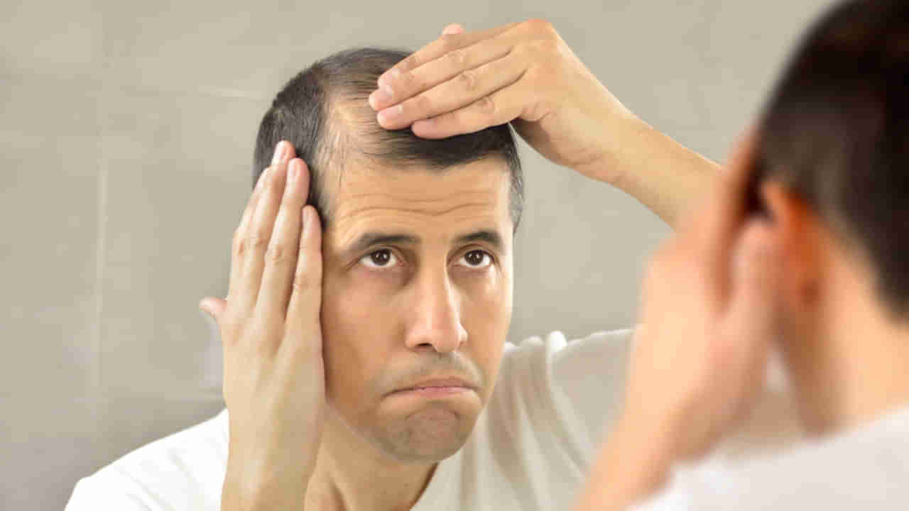 Causes of Baldness: మగవారిలో బట్టతల రావడానికి కారణాలు ఇవే!