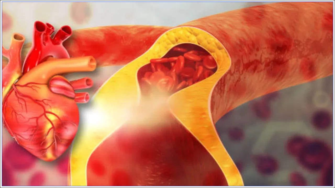 చాలా మంది 40 ఏళ్లలోపు కొలెస్ట్రాల్ సమస్యలతో బాధపడుతున్నారు. సమయం గడిచేకొద్దీ, ఈ ఎలివేటెడ్ కొలెస్ట్రాల్ స్థాయిలు ఆందోళన కలిగిస్తాయి. దీనితో పాటు గుండె జబ్బుల ముప్పు కూడా పెరుగుతోంది. అయితే చాలా మందికి అవగాహన లేదు. రక్తపోటు, మధుమేహం, కొలెస్ట్రాల్ స్థాయిలు సైలెంట్‌గా పెరుగుతాయి. అలాగే, చెడు కొలెస్ట్రాల్ స్థాయిలను అదుపులో ఉంచుకోవడం కూడా చాలా కష్టం. అయితే ఆరోగ్యానికి కొలెస్ట్రాల్‌ను అదుపులో ఉంచుకోవాలి.