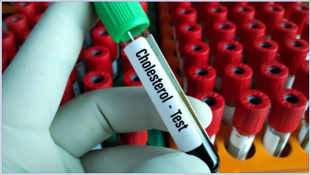 ధూమపానం వలె, మద్యపానం గురించి కూడా తెలుసుకోవడం చాలా ముఖ్యం. ఆల్కహాల్ వినియోగం మీ కొలెస్ట్రాల్ రకం ట్రైగ్లిజరైడ్స్ స్థాయిలను పెంచుతుంది. కాలేయం కూడా దెబ్బతింటుంది. అందుకే చెడు కొలెస్ట్రాల్ స్థాయిలను తగ్గించడానికి ఆల్కహాల్ తీసుకోవడం తగ్గించండి. 