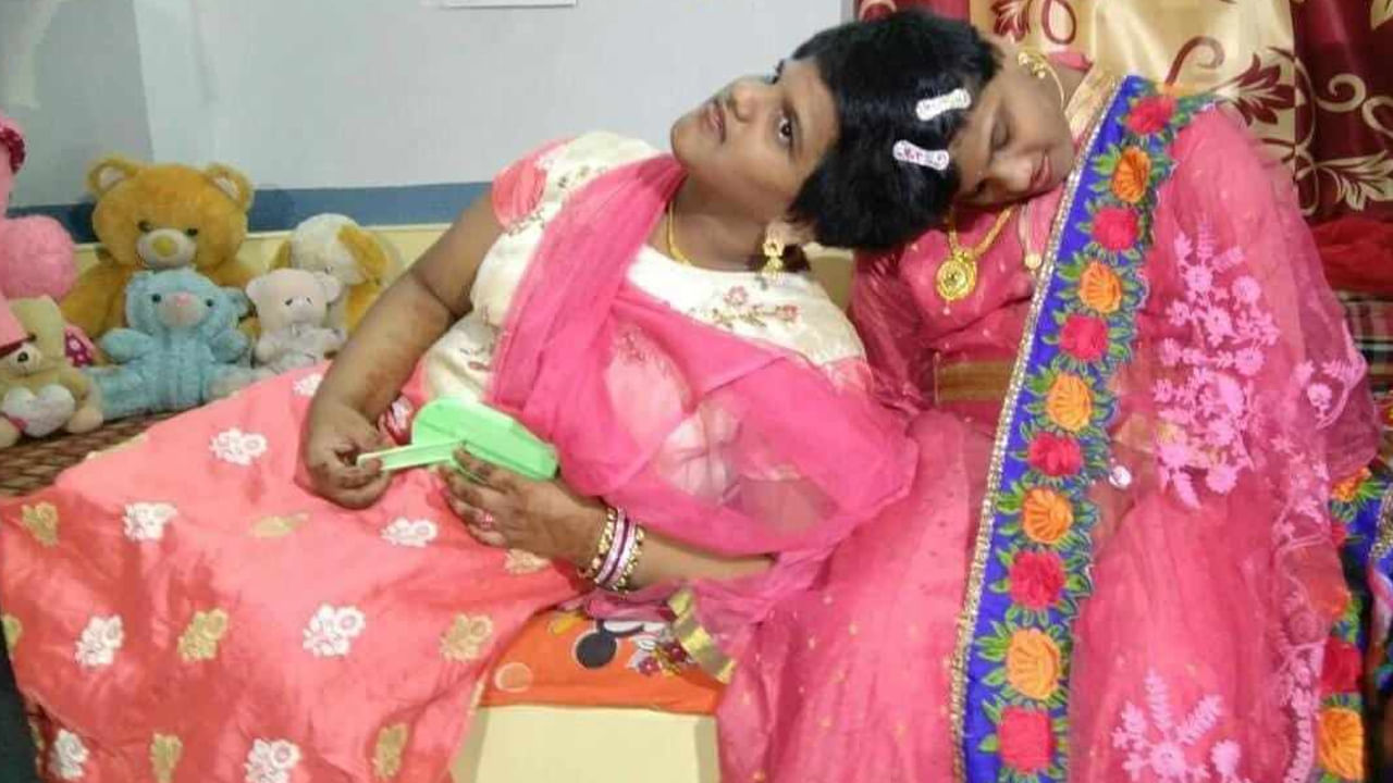 Veena-Vani Birthday: నేడే అవిభక్త కవలలు వీణ వాణిల పుట్టినరోజు.. చార్టెడ్ అకౌంట్ కావాలని కలలు కంటున్న వీణ వాణిలు..