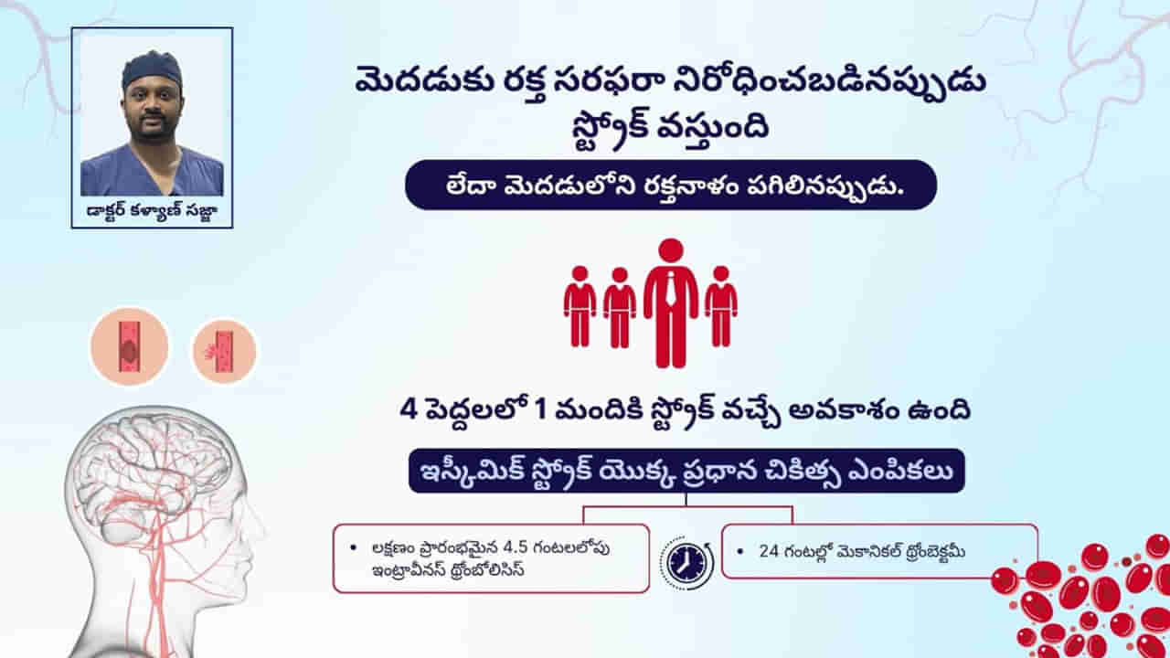 Stroke: ఆధునాతన చికిత్సతో స్ట్రోక్ క్రమాన్ని ఇలా అడ్డుకోండి.. మెకానికల్ థ్రోంబెక్టమీ వాగ్దానం..