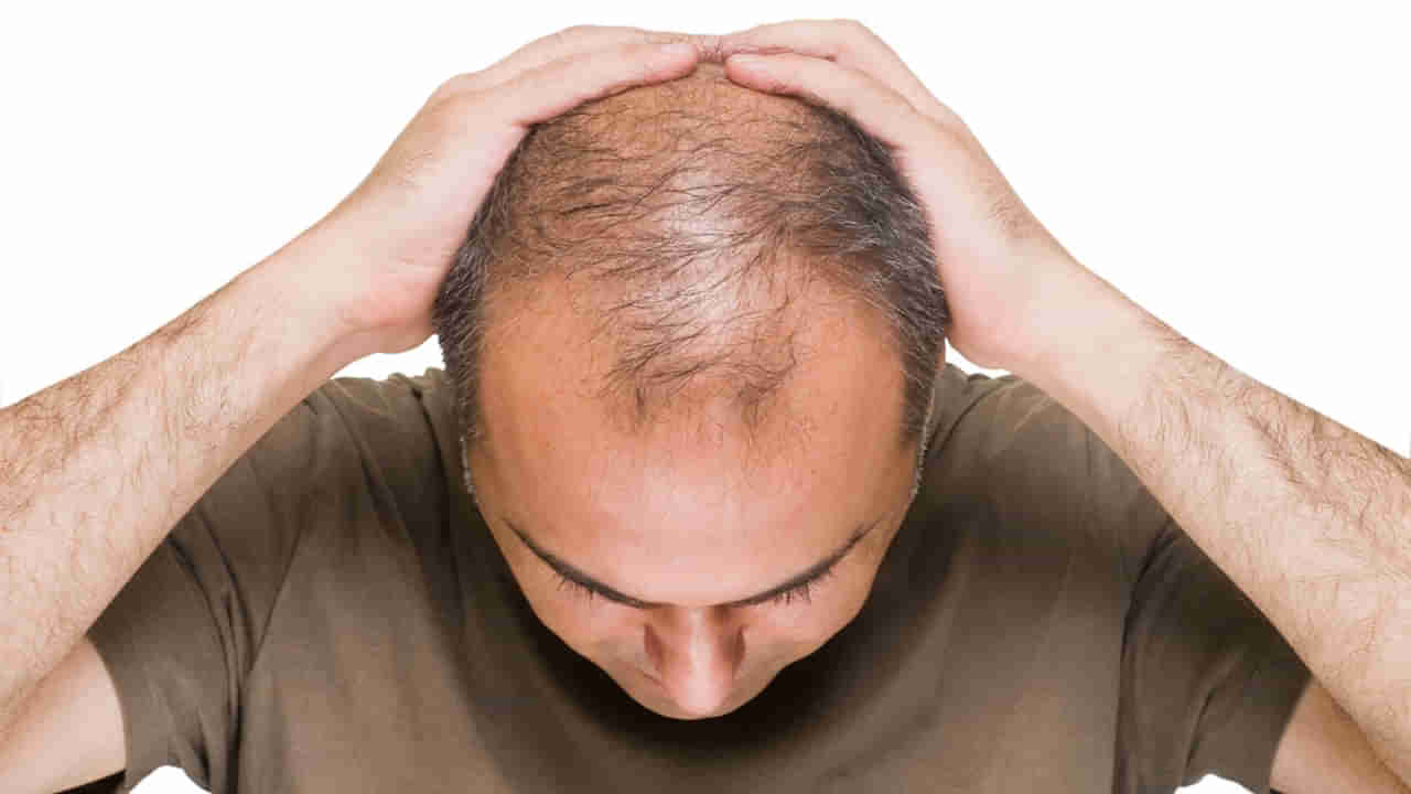 Hair Loss in Men: ఈ ఏడు కారణాల వల్ల పురుషుల్లో త్వరగా బట్టతల.. వీటిని పాటించండి