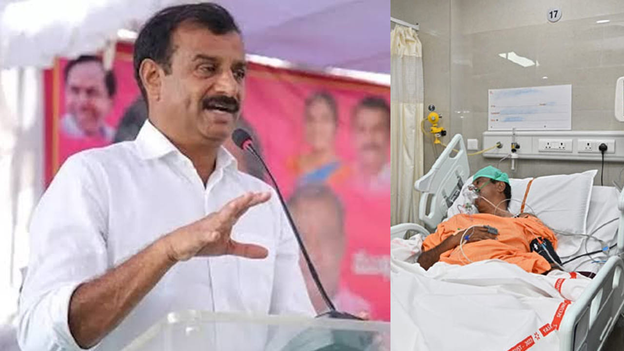 Kotha Prabhakar Reddy: నిలకడగా కొత్త ప్రభాకర్‌రెడ్డి ఆరోగ్యం.. తెలంగాణ ప్రభుత్వం కీలక నిర్ణయం..