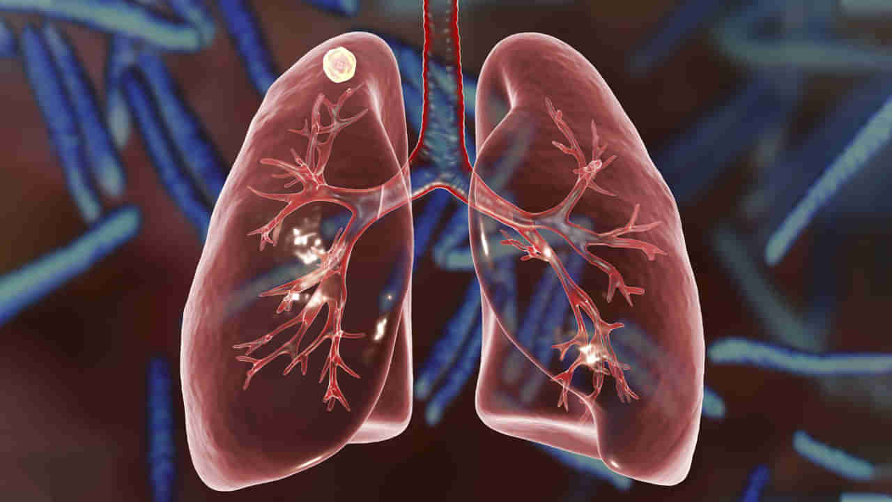 Lungs Precautions: మీ ఊపిరి తిత్తులను ఆరోగ్యంగా ఉండాలంటే.. ఈ తప్పులు అస్సలు చేయండి!