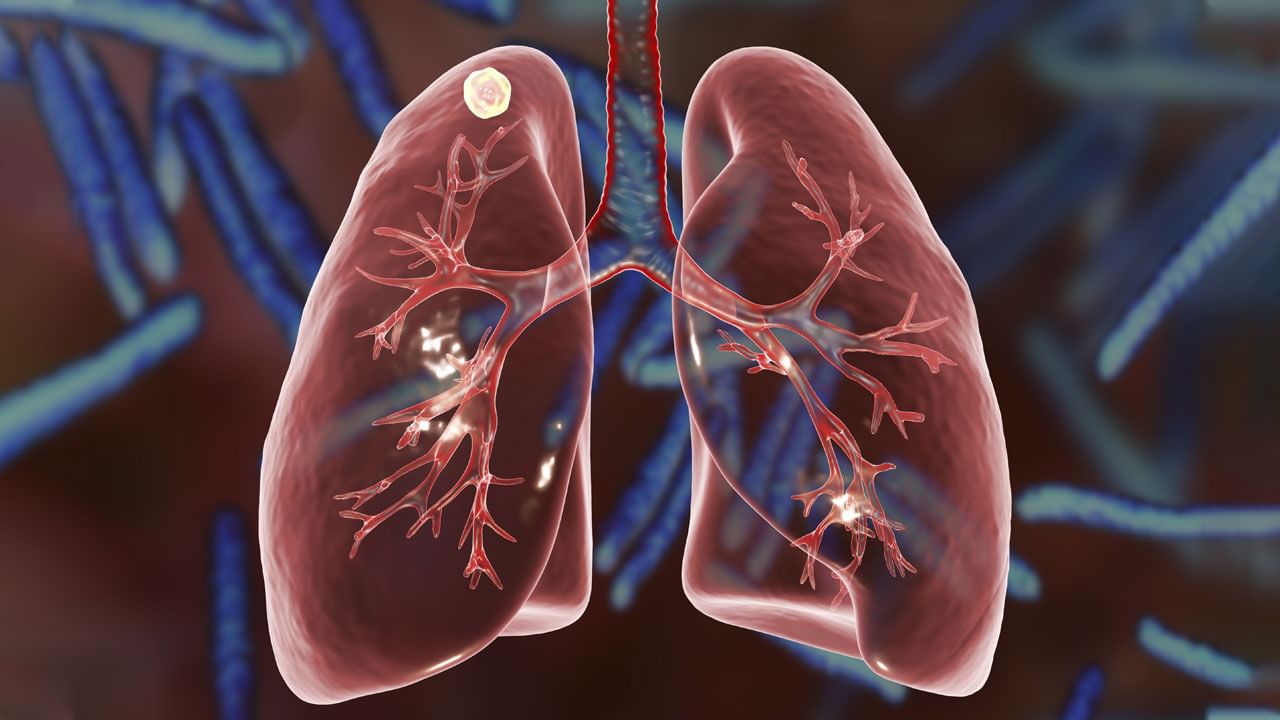 Lungs Precautions: మీ ఊపిరి తిత్తులను ఆరోగ్యంగా ఉండాలంటే.. ఈ తప్పులు అస్సలు చేయండి!