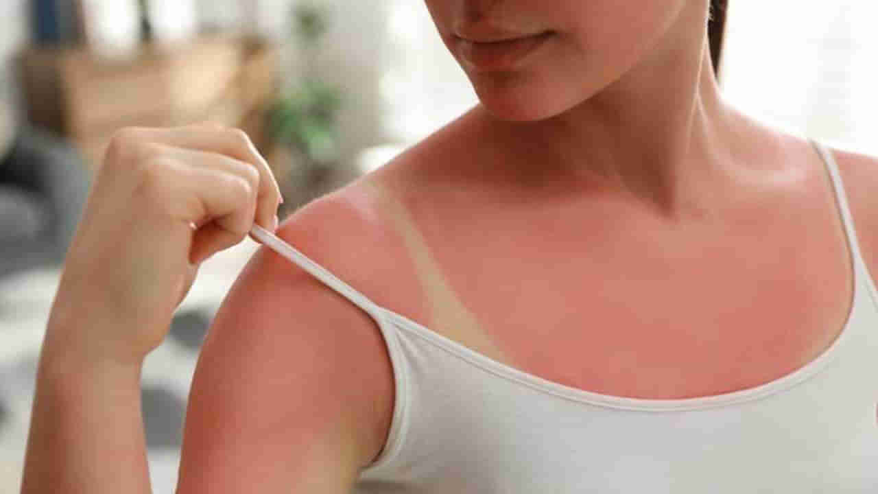 Sun Tan Removal Tips: ఈ ఫేస్ ప్యాక్‌లు ట్రై చేశారంటే.. సహజంగా స్కిన్ ట్యాన్‌ వదలిపోతుంది