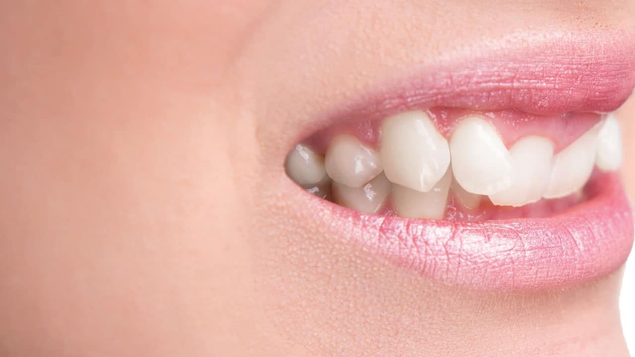 Teeth Health: మీ దంతాల రంగు బట్టి.. మీ ఆరోగ్యం ఎలా ఉందో చెప్పొచ్చు!