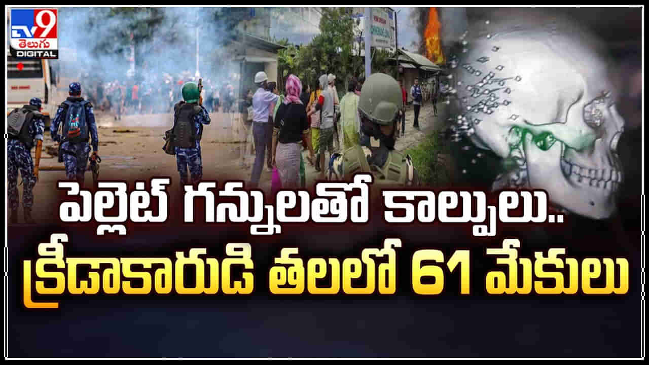 Manipur: మణిపూర్ లో దారుణం.. పెల్లెట్‌ గన్నులతో క్రీడాకారుడి తలలో 61 మేకులు..