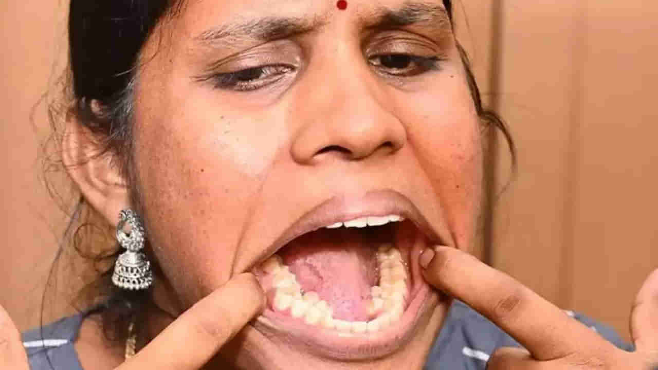Viral News: వామ్మో.. ఆమె నోట్లో ఏకంగా 38 పళ్లున్నాయ్‌.. అందరి చూపూ ఆమెపైనే.. గిన్నీస్ రికార్డ్ క్రియేట్‌ చేసింది..