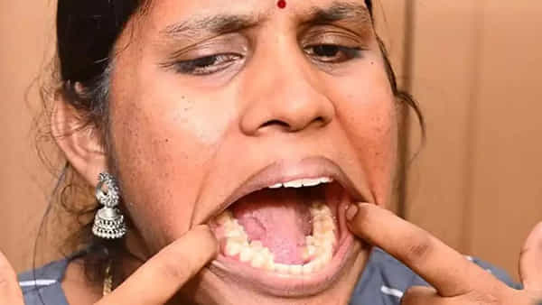 Viral News: వామ్మో.. ఆమె నోట్లో ఏకంగా 38 పళ్లున్నాయ్.. అందరి చూపూ ఆమెపైనే.. గిన్నీస్ రికార్డ్ క్రియేట్ చేసింది..