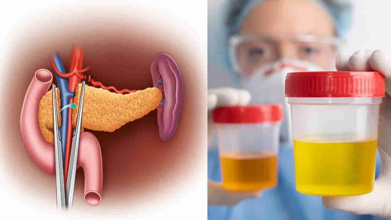 Health: మూత్రంలో ఈ లక్షణాలా.? క్లోమగ్రంథి దెబ్బతినొచ్చు..