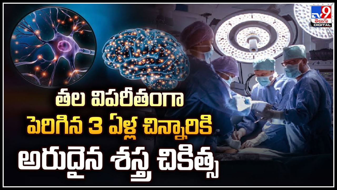 Eisenmenger syndrome: తల విపరీతంగా పెరిగిన 3 ఏళ్ల చిన్నారికి అరుదైన శస్త్ర చికిత్స.