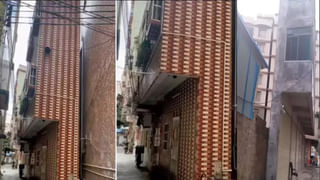 చిన్నారి ఊపిరితిత్తుల్లో గుచ్చుకున్న కుట్టుమిషన్‌ సూది.. అయస్కాంతంతో తొలిగించిన వైద్యులు.. ఇదోక అద్భుతం