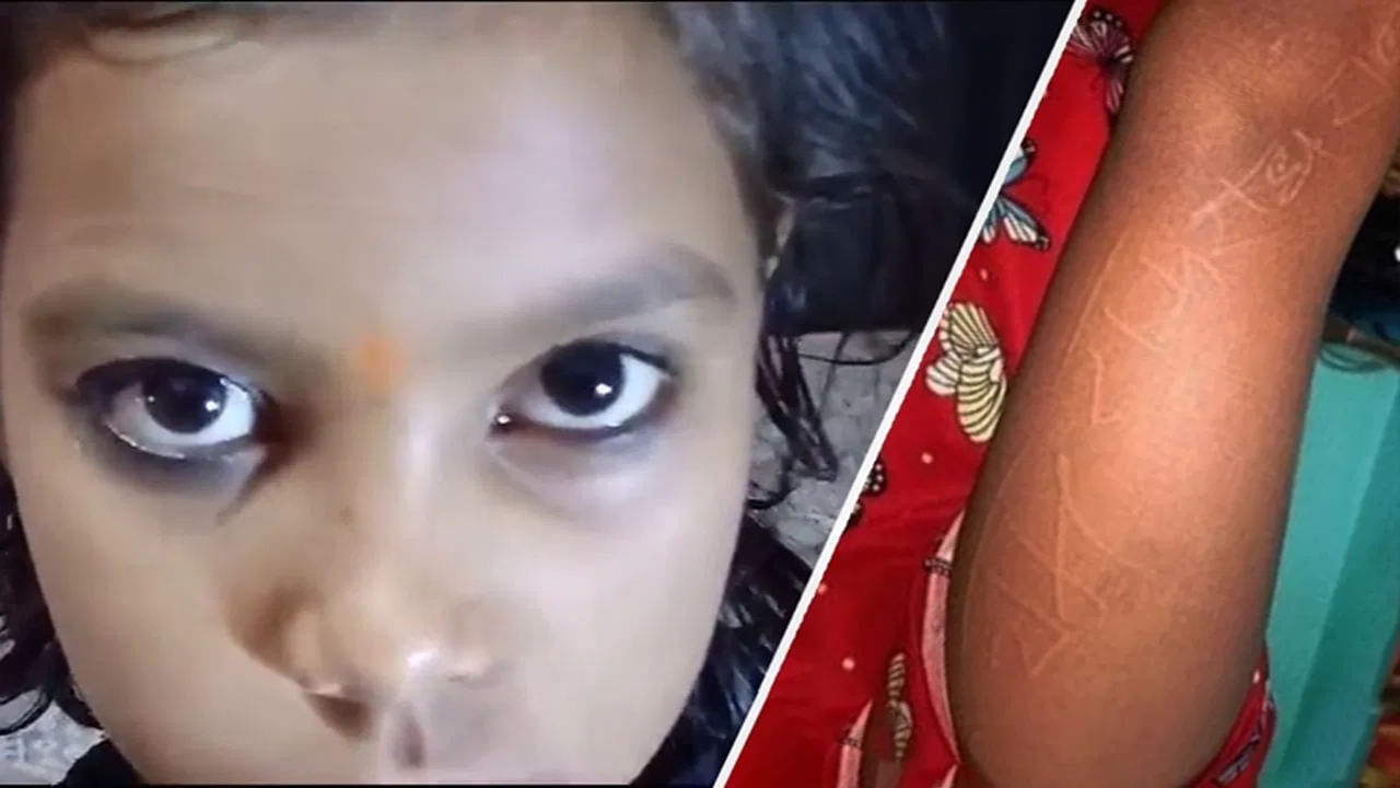 Viral Video: చిన్నారి బాలిక శరీరంపై రామ్, రాధా పేర్లు .. వైద్యులకు షాక్.. దైవానుగ్రహము అంటున్న తాత