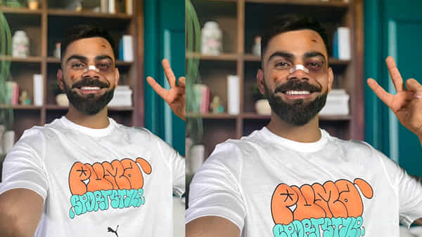 Virat Kohli: ముఖానికి గాయాలు.. ముక్కుపై బ్యాండేజ్.. విరాట్ కోహ్లీకి ఏమైంది? కంగారు పడుతోన్న ఫ్యాన్స్