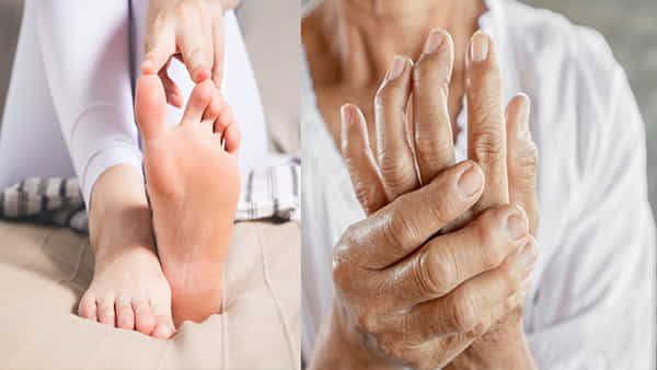 Arthritis: ఆర్థరైటిస్ రోగులు శీతాకాలంలో ఈ పొరపాట్లు చేయవద్దు.. తీవ్రమైన ఇబ్బంది పడతారు..