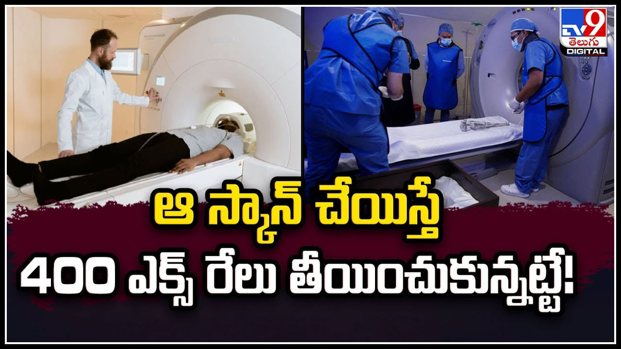 CT Scan Risk: ఆ స్కాన్ చేయిస్తే 400 ఎక్స్ రేలు తీయించుకున్నట్టే.! సీటీస్కాన్‌తో యమ డేంజర్.!