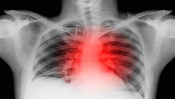 Heart attack and stroke: ఉదయం బ్రేక్ ఫాస్ట్ అలస్యంగా తింటున్నారా? ప్రతి గంటకూ ఏం జరుగుతుందో తెలిస్తే పరేషాన్